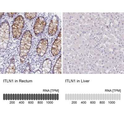 Immunohistochemistry-Paraffin: Intelectin-1/Omentin Antibody [NBP2-38989]