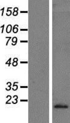 Western Blot: IFN-alpha C/IFN-alpha 10 Overexpression Lysate [NBP2-10810]