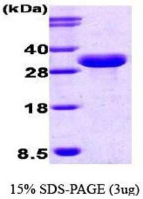 SDS-PAGE: Recombinant Human ISG15/UCRP Calmodulin Protein [NBC1-18442]