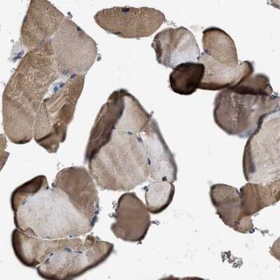Immunohistochemistry-Paraffin: Intersectin 1 Antibody [NBP1-87806]