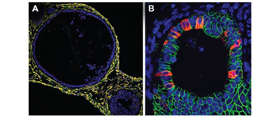 iPSC-derived Human Intestinal Organoid