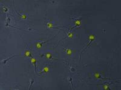 Immunocytochemistry/ Immunofluorescence: p97/VCP Antibody (Hs-14) [NB500-455]
