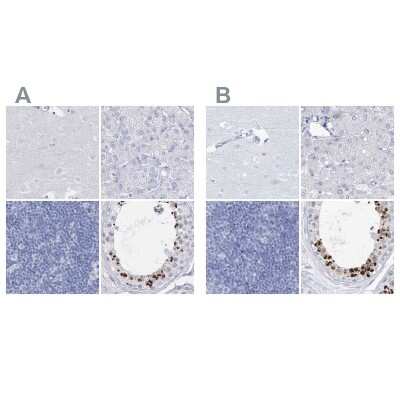 Immunohistochemistry-Paraffin: Intra Acrosomal Protein Antibody [NBP1-88038]