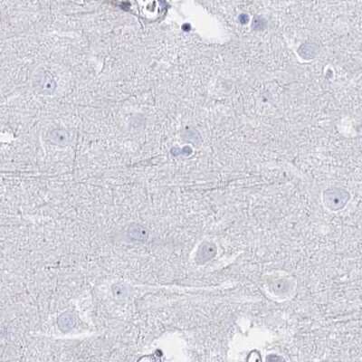 Immunohistochemistry-Paraffin: Intra Acrosomal Protein Antibody [NBP1-88038]