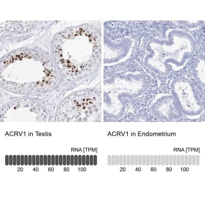 Immunohistochemistry-Paraffin: Intra Acrosomal Protein Antibody [NBP2-34054]