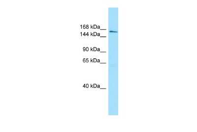 Western Blot: Intron-Binding Protein Of 160 KDa Antibody [NBP2-87631]