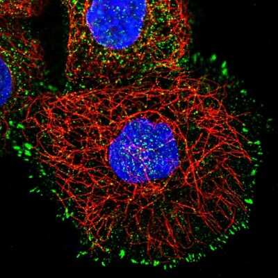Immunocytochemistry/ Immunofluorescence: Invadolysin Antibody [NBP1-92025]
