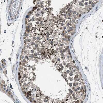 Immunohistochemistry-Paraffin: Invadolysin Antibody [NBP1-92024]