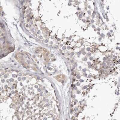 Immunohistochemistry-Paraffin: Invadolysin Antibody [NBP1-92025]
