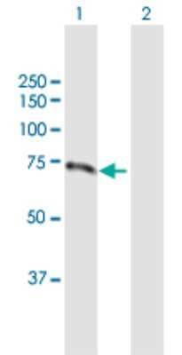 Western Blot: Invadolysin Antibody [H00089782-B01P]