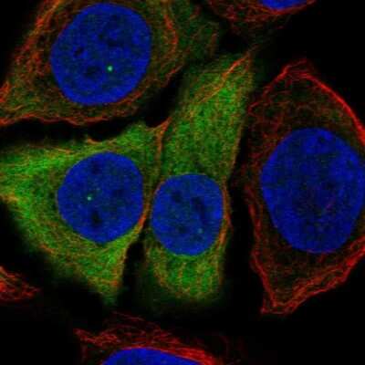 Immunocytochemistry/ Immunofluorescence: Involucrin Antibody [NBP2-33742]