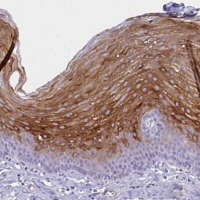 Immunohistochemistry-Paraffin: Involucrin Antibody [NBP2-33742]