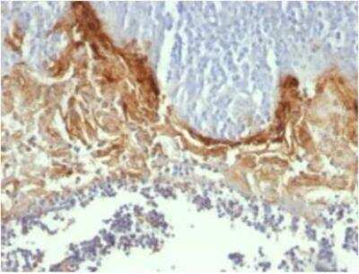 Immunohistochemistry-Paraffin: Involucrin Antibody (SY5) - BSA Free [NB100-2727]
