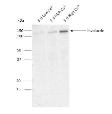 Western Blot: Involucrin Antibody (SY5)BSA Free [NB100-2727]