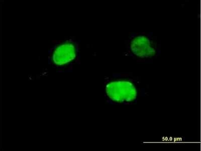 Immunocytochemistry/ Immunofluorescence: Iroquois-class homeodomain protein IRX-5 Antibody (8A12) [H00010265-M06]