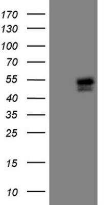 Western Blot: Islet-1 Antibody (OTI2D8) [NBP2-45452]