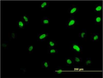 Immunocytochemistry/ Immunofluorescence: Islet-1 Antibody (2E7) [H00003670-M05]