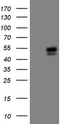 Western Blot: Islet-1 Antibody (OTI2D8)Azide and BSA Free [NBP2-71050]
