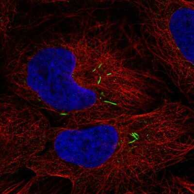 Immunocytochemistry/ Immunofluorescence: Islet-2 Antibody [NBP2-57938]