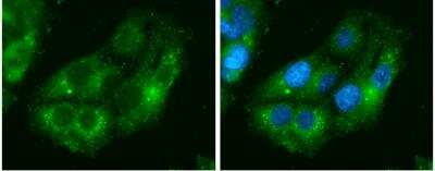 Immunocytochemistry/ Immunofluorescence: Isocitrate Dehydrogenase 1/IDH1 Antibody (1521) [NBP2-43692]