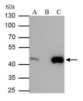 Immunoprecipitation: Isocitrate Dehydrogenase 1/IDH1 Antibody (1521) [NBP2-43692]