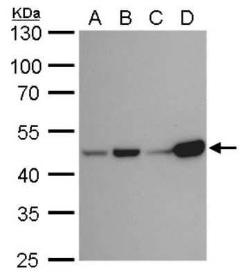 Western Blot: Isocitrate Dehydrogenase 1/IDH1 Antibody (1521) [NBP2-43692]