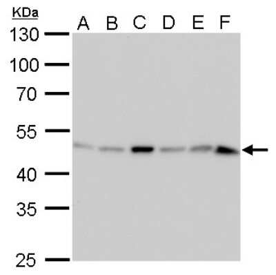 Western Blot: Isocitrate Dehydrogenase 1/IDH1 Antibody (1521) [NBP2-43692]