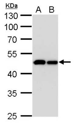 Western Blot: Isocitrate Dehydrogenase 1/IDH1 Antibody (1521) [NBP2-43692]
