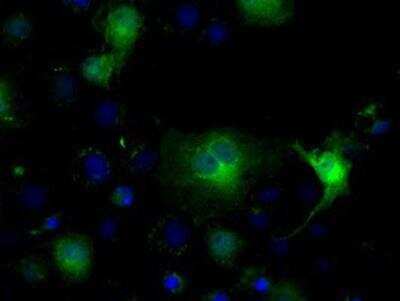 Immunocytochemistry/ Immunofluorescence: Isocitrate Dehydrogenase 1/IDH1 Antibody (OTI2H9) [NBP1-47804]