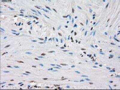 Immunohistochemistry-Paraffin: Isocitrate Dehydrogenase 1/IDH1 Antibody (OTI2H9) [NBP1-47804]