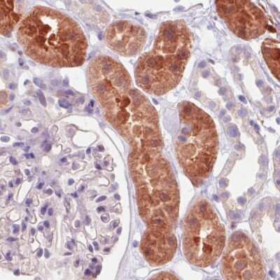 Immunohistochemistry-Paraffin: Isocitrate Dehydrogenase 1/IDH1 Antibody (CL0219) [NBP2-52882]