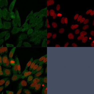 Immunocytochemistry/ Immunofluorescence: Isocitrate Dehydrogenase 1/IDH1 Antibody (IDH1/1152) - Azide and BSA Free [NBP2-47744]