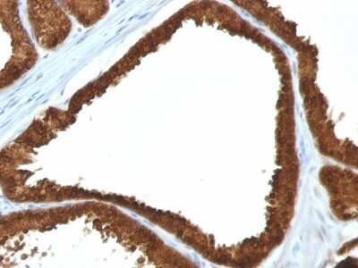 Immunohistochemistry-Paraffin: Isocitrate Dehydrogenase 1/IDH1 Antibody (IDH1/1152) - Azide and BSA Free [NBP2-47744]