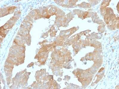 Immunohistochemistry-Paraffin: Isocitrate Dehydrogenase 1/IDH1 Antibody (IDH1/1152) - Azide and BSA Free [NBP2-47744]