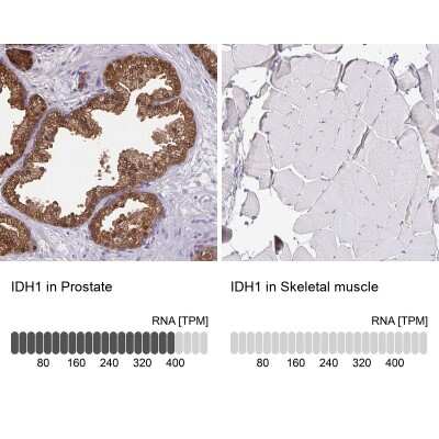 Immunohistochemistry-Paraffin: Isocitrate Dehydrogenase 1/IDH1 Antibody [NBP1-87428]