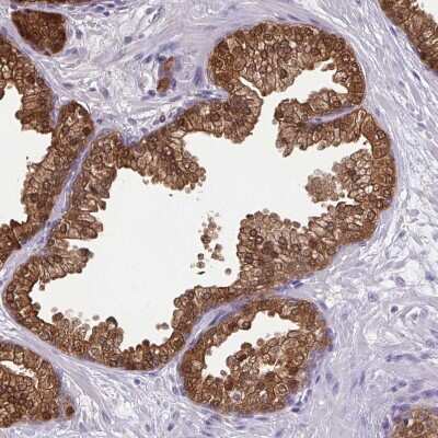 Immunohistochemistry-Paraffin: Isocitrate Dehydrogenase 1/IDH1 Antibody [NBP1-87428]
