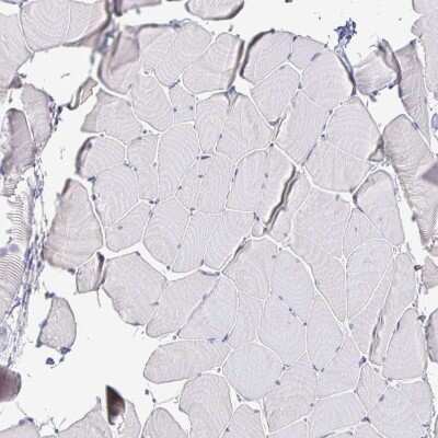 Immunohistochemistry-Paraffin: Isocitrate Dehydrogenase 1/IDH1 Antibody [NBP1-87428]