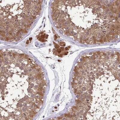 Immunohistochemistry-Paraffin: Isocitrate Dehydrogenase 1/IDH1 Antibody [NBP1-87428]