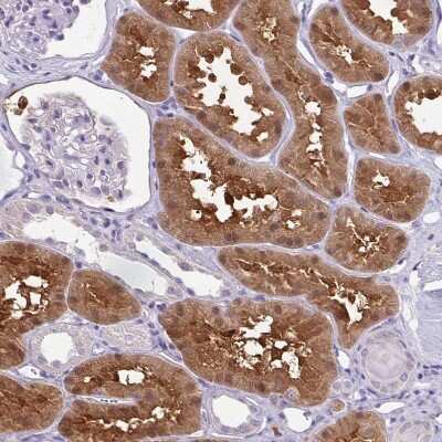 Immunohistochemistry-Paraffin: Isocitrate Dehydrogenase 1/IDH1 Antibody [NBP1-87428]