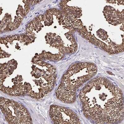 Immunohistochemistry-Paraffin: Isocitrate Dehydrogenase 1/IDH1 Antibody [NBP2-34091]