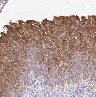 Immunohistochemistry-Paraffin: Isocitrate Dehydrogenase 1/IDH1 Antibody [NBP2-34091]