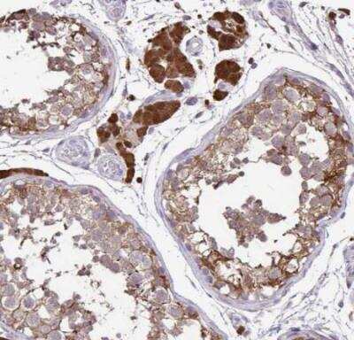 Immunohistochemistry-Paraffin: Isocitrate Dehydrogenase 1/IDH1 Antibody [NBP2-34091]