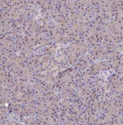Immunohistochemistry-Paraffin: Isocitrate Dehydrogenase 1/IDH1 Antibody [NBP2-34091]
