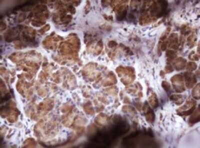 Immunohistochemistry: Isocitrate Dehydrogenase 1/IDH1 Antibody (OTI1D1) - Azide and BSA Free [NBP2-70990]