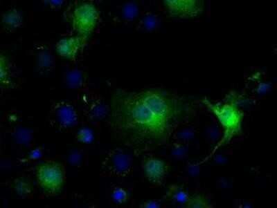 Immunocytochemistry/ Immunofluorescence: Isocitrate Dehydrogenase 1/IDH1 Antibody (OTI2H9) - Azide and BSA Free [NBP2-70988]