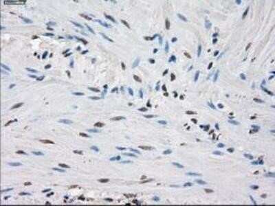 Immunohistochemistry: Isocitrate Dehydrogenase 1/IDH1 Antibody (OTI2H9) - Azide and BSA Free [NBP2-70988]