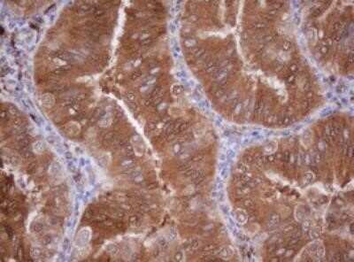 Immunohistochemistry: Isocitrate Dehydrogenase 1/IDH1 Antibody (OTI3G9) - Azide and BSA Free [NBP2-70989]