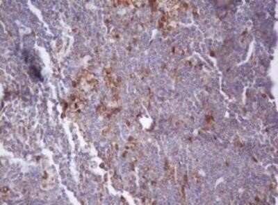 Immunohistochemistry: Isocitrate Dehydrogenase 1/IDH1 Antibody (OTI3G9) - Azide and BSA Free [NBP2-70989]