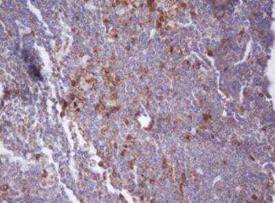 Immunohistochemistry-Paraffin: Isocitrate Dehydrogenase 1/IDH1 Antibody (OTI3G9) [NBP2-46018]