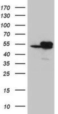 Western Blot: Isocitrate Dehydrogenase 1/IDH1 Antibody (OTI3G9) [NBP2-46018]